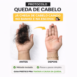 Protocolo de Queda Capilar