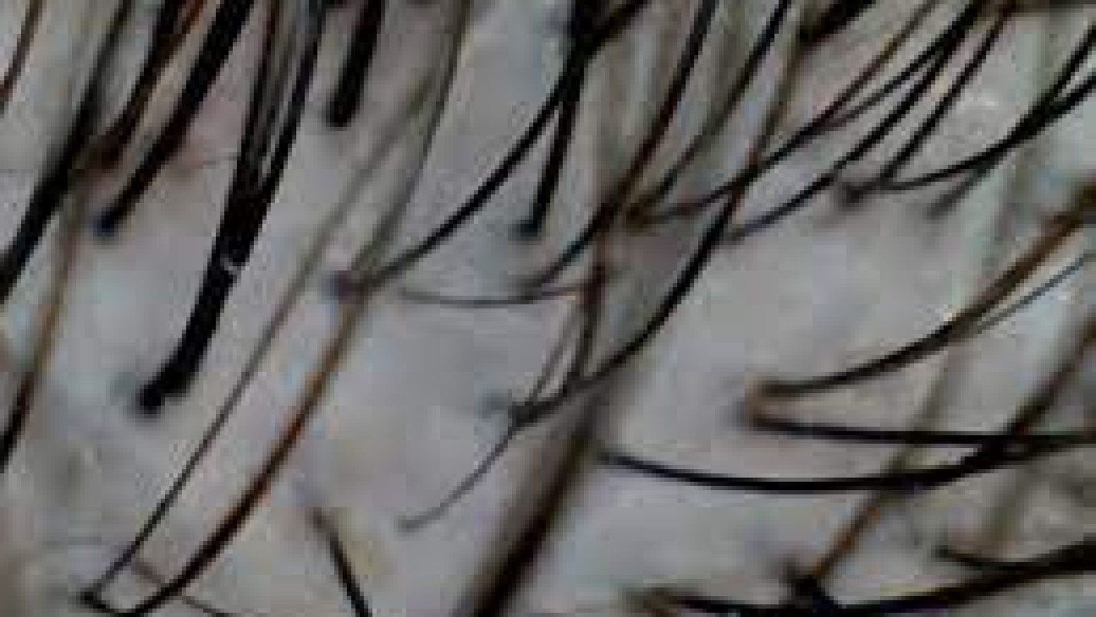 à queda. Isso acontece porque a inflamação gera alterações na sinalização químic